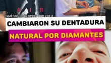 Famosos que se cambiaron su dentadura natural por diamantes