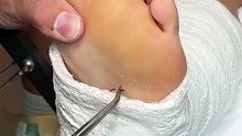 So gross!  #gross #reels #fyp #viral #doctor