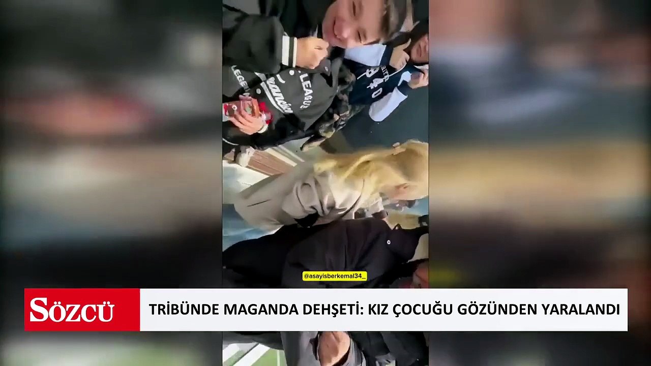 Tribünde maganda dehşeti: Kız çocuğu gözünden yaralandı!