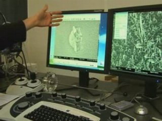 Le microscope électronique à balayage (MEB)