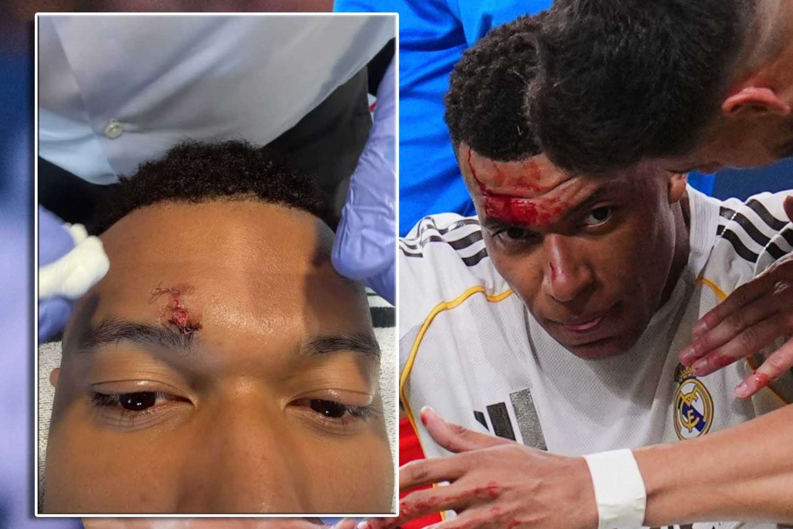 Mbappé no se entrena<br>