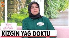 Eski eşim yüzünden, vücudumun %70'i yanık - Esra Erol'da 13 Nisan 2026