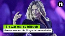 Helene Fischer: "Sie war mal so hübsch" - Fans erkennen die Sängerin kaum wieder