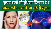 Optic Nerve Swelling Treatment: सुबह उठते ही धुंधला दिखने का कारण,इलाज | Causes In Hindi