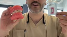 Limer entre tes dents