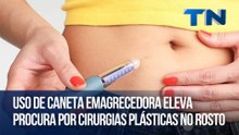 Uso de caneta emagrecedora eleva procura por cirurgias plásticas no rosto