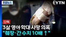[단독] 양주 학대 의혹 3살 사망..."췌장·간 수치 10배 이상" / YTN