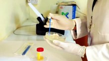 Urine culture lab test