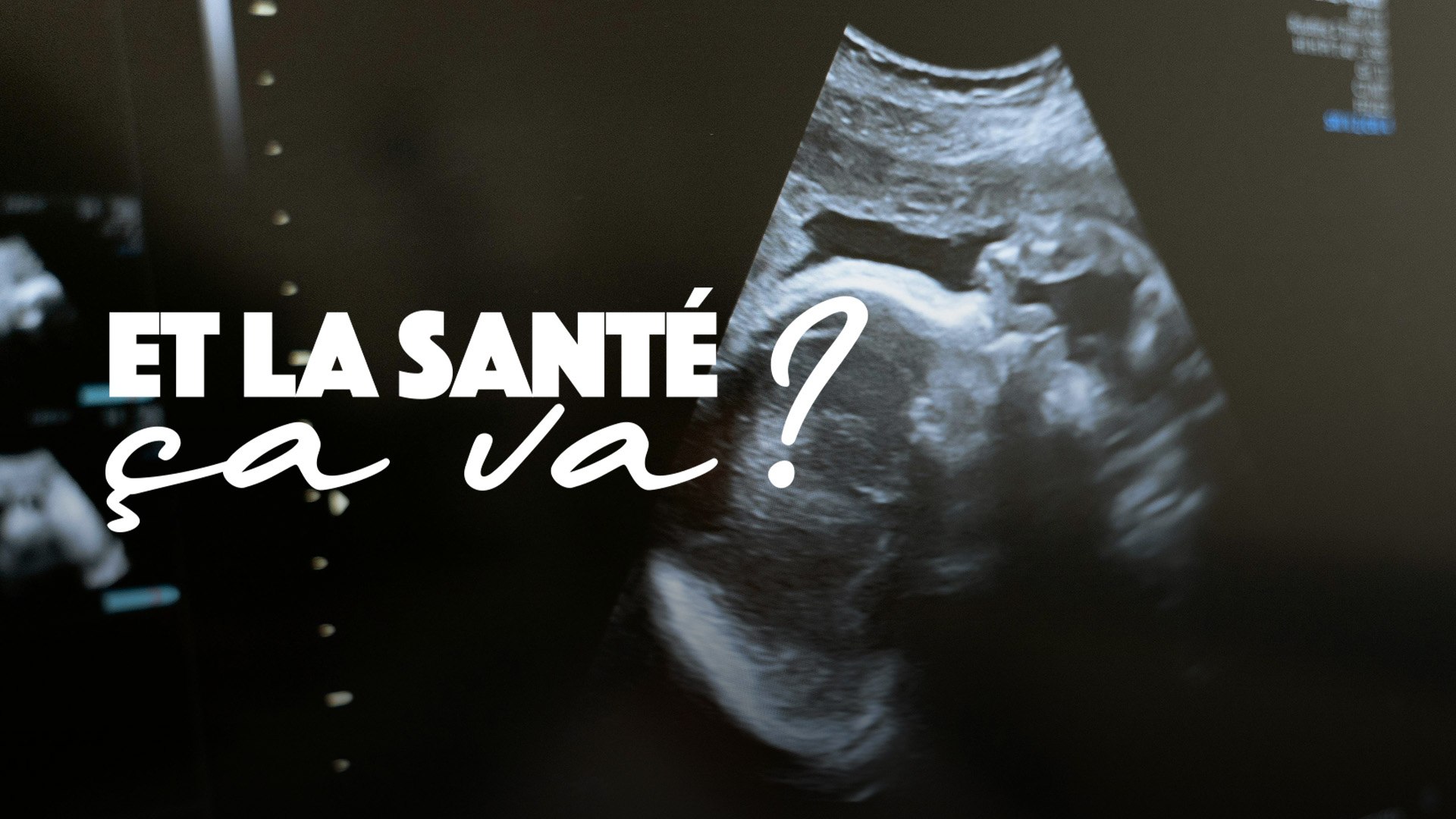 Dénatalité : comment inverser la tendance ?