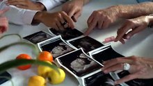 Ultrasound_Stock_Footage_-_Ultrasound_Free_Stock_Videos_-_Ultrasound_No_Copyright_Videos(0)