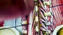 Muscle weakness physical therapy treatment