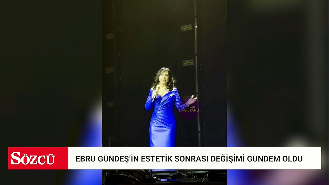 Ebru Gündeş’in estetik sonrası değişimi gündem oldu: Kıvanç Tatlıtuğ ile rol almak istiyor