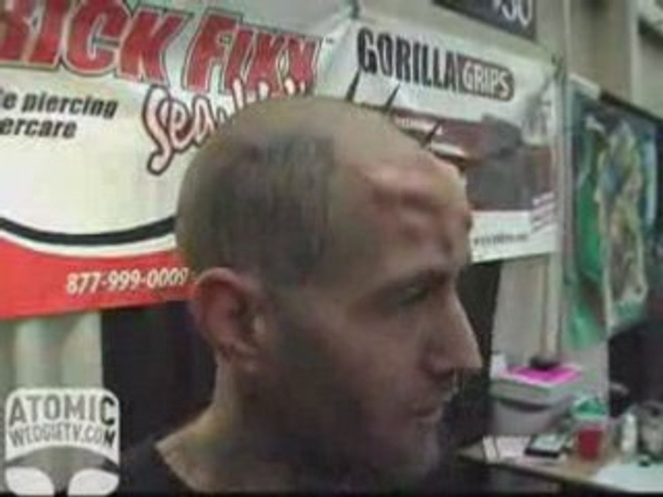 implant hardcore