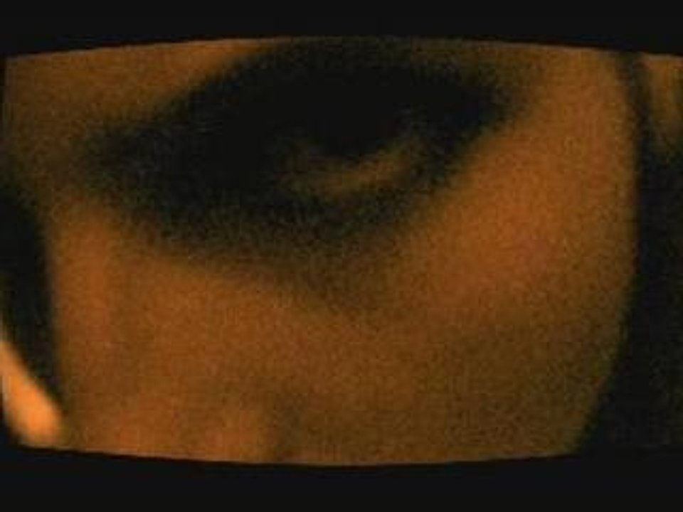 Anamorphe