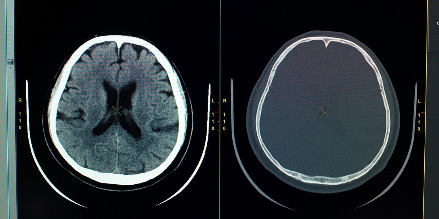 Episode-5 Bloodhounds (Season-2) New Korean Drama In Hindi Dubbed [Full Movie] [Trending]Full EP - Full