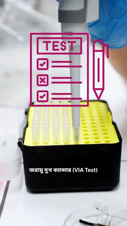 VIA test