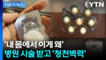 산부인과 시술 뒤 몸에서 '충격'...담당 의사, 뒤늦게 인정 [지금이뉴스] / YTN