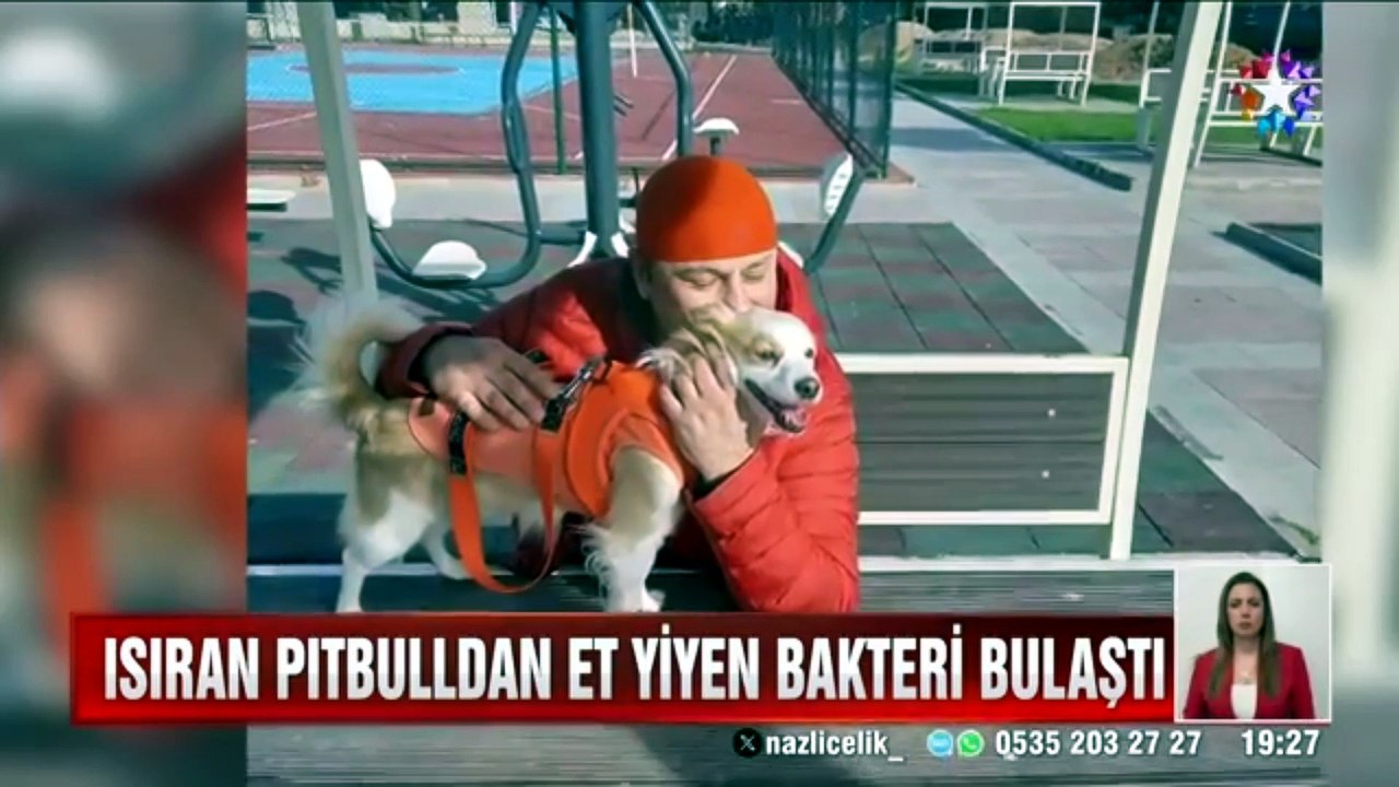 Onur Akay pitbull saldırısına uğradı! Star TV Ana Haber'de