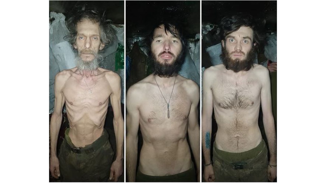 '영양실조' 우크라 병사 사진에 공분...보급 지휘관 해임 / YTN