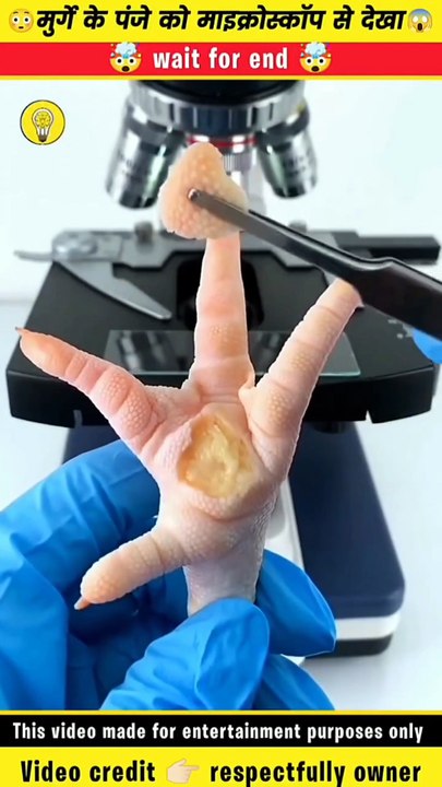 What was found when viewed through a microscope?