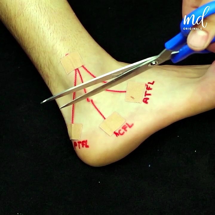 Massage therapy sessions & taping techniques