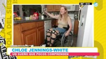 Chloe Jennings-White, la científica que busca la amputación de sus piernas