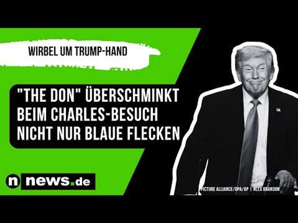 Wirbel um Trump-Hand: 'The Don' überschminkt beim Charles-Besuch nicht nur blaue Flecken