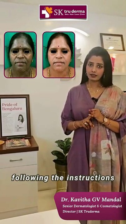 Not Melasma? Know the Real Skin Condition Before You Treat | SK Truderma Skin Clinic Sarjapur Road