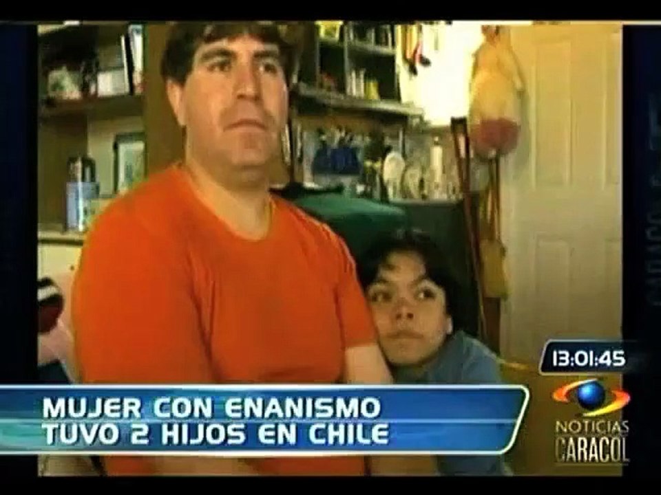 Mujer con acondroplasia