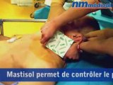 Mastisol & détachol en anesthésie/réanimation