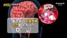 [예고] 대물림 중인 뇌동맥류! 눈을 보면 혈관 상태 파악 가능하다?