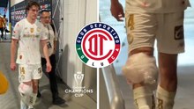 Marcel Ruiz sale del juego contra LAFC con hielo en la rodilla tras su baja de Selección Mexicana