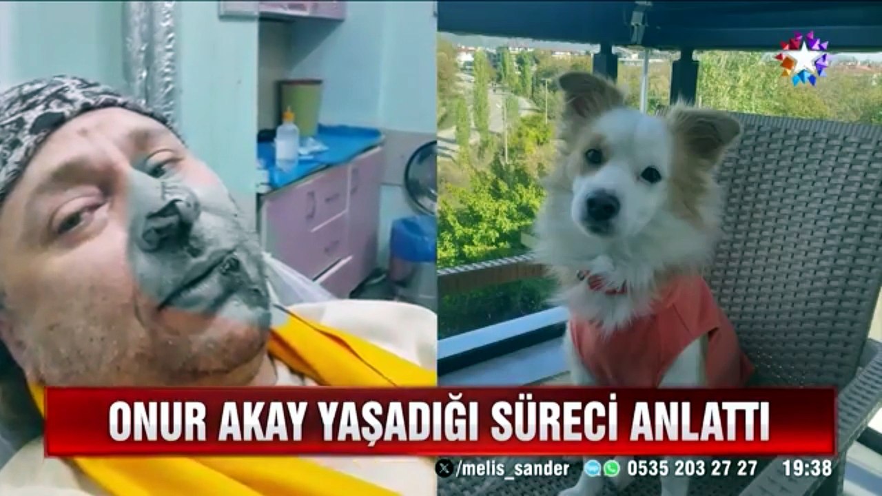 Taburcu olan sanatçı Onur Akay pitbull saldırısını anlattı! Star TV Ana Haber Bülteni'nde
