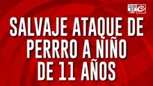 Salvaje ataque de un perro a niño de once años. Mirá el video
