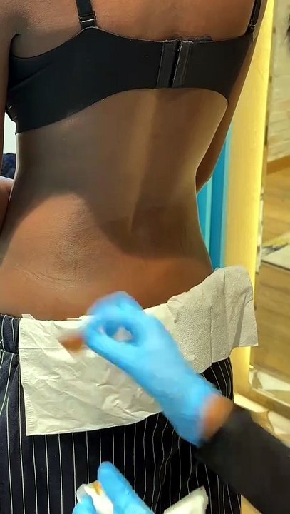 Back Dermal Piercings: Beauty, Pain & What I Wish I Knew First 💫 #dermalpiercing #bodypiercing