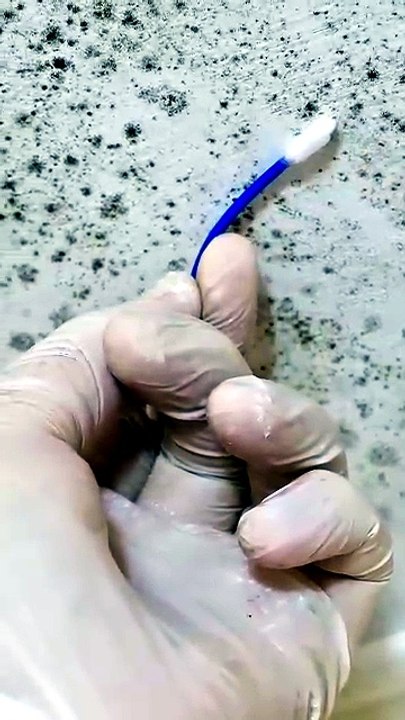 Invisible Danger: Mold in Your Home | Green Planet Restoration