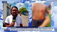 CRIANÇA GRAVEMENTE FERIDA POR UM VERGALJÃO DE FERRO EM SOURE NO MARAJÓ