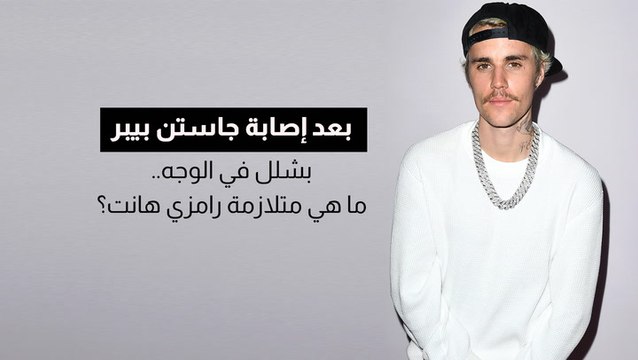 بعد إصابة جاستن بيبر بشلل في الوجه.. ما هي متلازمة رامزي هانت؟