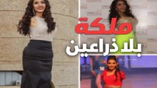 موديل بلا ذراعين تتحدى ملكات الجمال