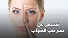 تخلصي من حفر حب الشباب