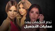 ندم النجمات بعد عمليات التجميل