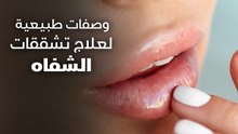وصفات طبيعية لعلاج تشققات الشفاه