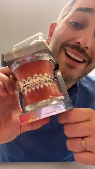 Tu sais te brosser les dents avec des bagues ?