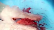 From Top Surgeon to Trash [Full Movie] [Vertical Drama]Full EP - Full