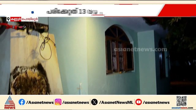 കണ്ണൂരിൽ സ്ഫോടക വസ്തു പൊട്ടിത്തെറിച്ച് പരിക്കേറ്റ 13കാരന്റെ ശസ്ത്രക്രിയ പൂർത്തിയായി