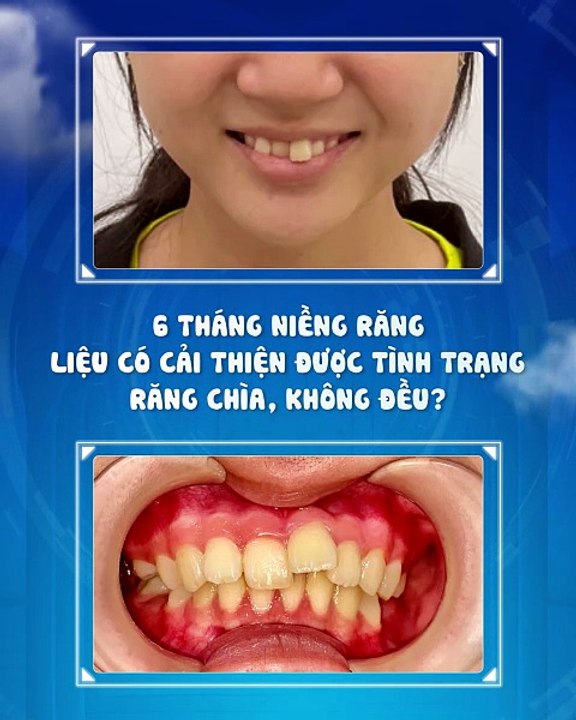MOTION THAY DOI NIENG RANG