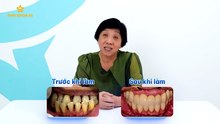 PVKH IMPLANT_CO CHI_16 9_K CTKM