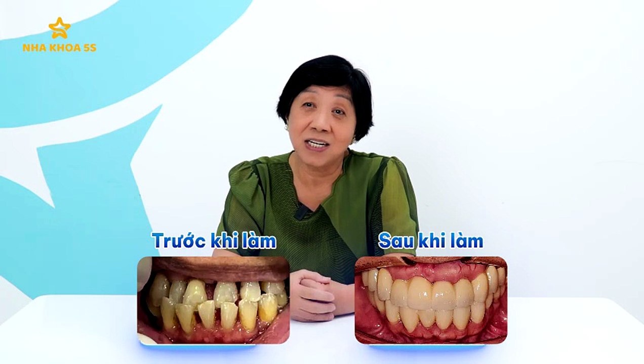 PVKH IMPLANT_CO CHI_16 9_K CTKM