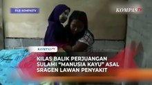 Intip Lagi Kisah Sulami Manusia Kayu Asal Sragen Lawan Penyakit Jadi Sorotan Dunia  ARSIP KOMPAS