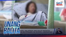2 estudyante, nalapnos ang balat matapos masabuyan ng ethanol sa school laboratory | Unang Balita